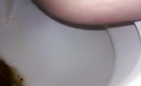 Hairy wife pooping in close up for us