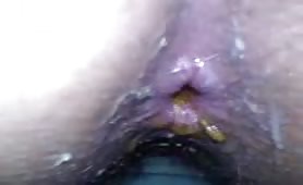 Hairy girl pooping in close up