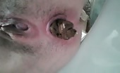 Pushing hard POV